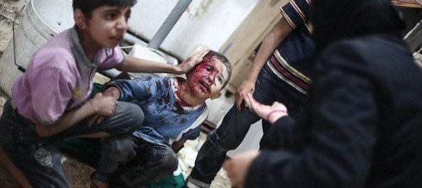 Wounded Syrian child